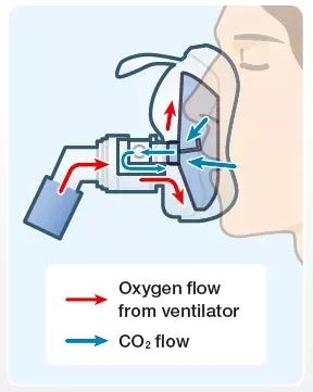 cap-ONE image 09