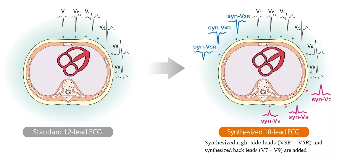 synECi18 image 01